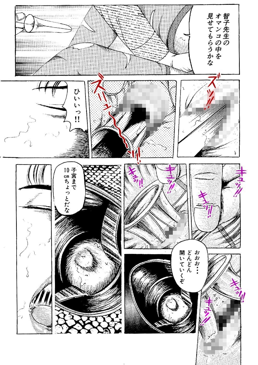 女医 拡げられた穴 サンプル 3