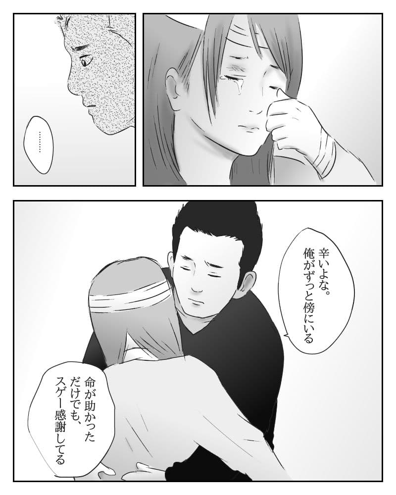 愛と真心と火傷 サンプル 1
