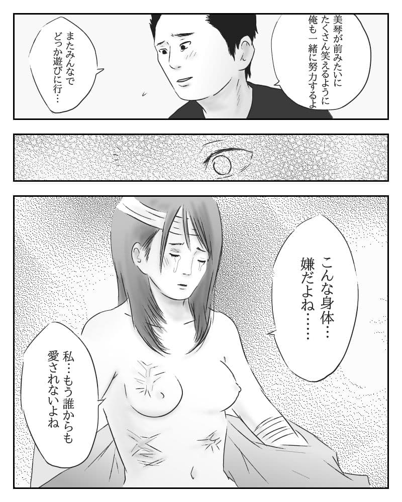 愛と真心と火傷 サンプル 2