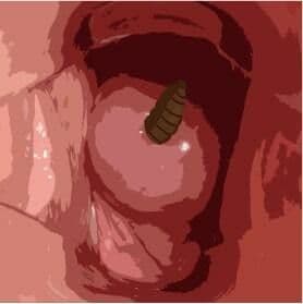 わたしの蟲姦遊び 第8話 大きいミズアブの幼虫編 全編 サンプル 2