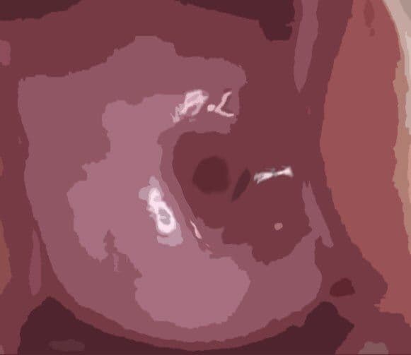 私の蟲姦遊び 第10話 妊娠中にウジ虫編 サンプル 2