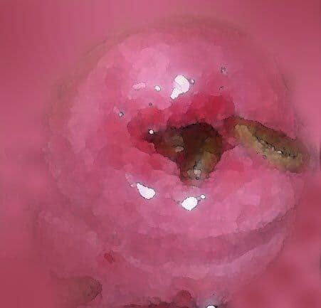 私の蟲姦遊び 第10話 妊娠中にウジ虫編 サンプル 3