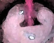 私の蟲姦遊び 第10話 妊娠中にウジ虫編 サンプル 4