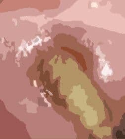 私の蟲姦遊び 第10話 妊娠中にウジ虫編 サンプル 5