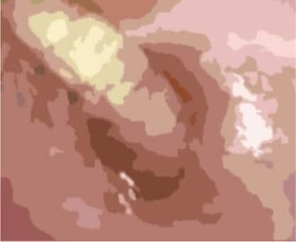 私の蟲姦遊び 第11話 妊娠中にカミキリ虫の幼虫とゴキブリの卵編 全編 サンプル 2