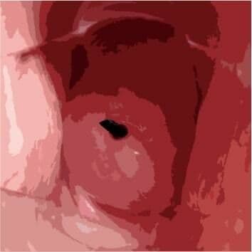 私の蟲姦遊び 第11話 妊娠中にカミキリ虫の幼虫とゴキブリの卵編 全編 サンプル 4