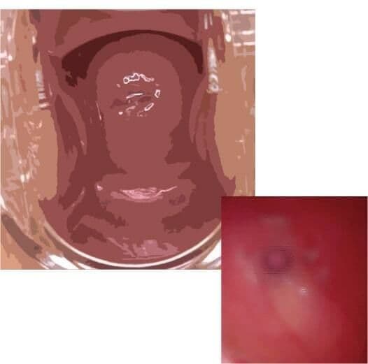 私の蟲姦遊び 第11話 妊娠中にカミキリ虫の幼虫とゴキブリの卵編 全編 サンプル 5