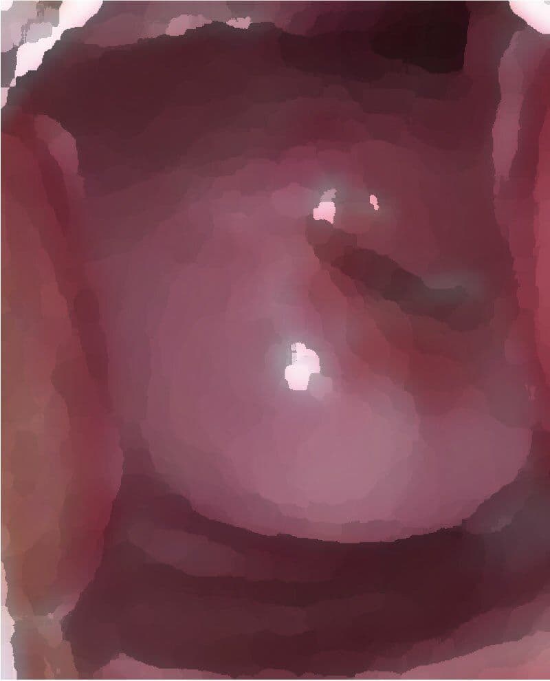 私の蟲姦遊び 第12話 妊娠中にナメクジとナメクジの卵編 全編 サンプル 1