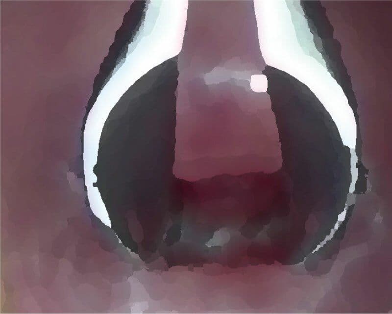 私の蟲姦遊び 第12話 妊娠中にナメクジとナメクジの卵編 全編 サンプル 2