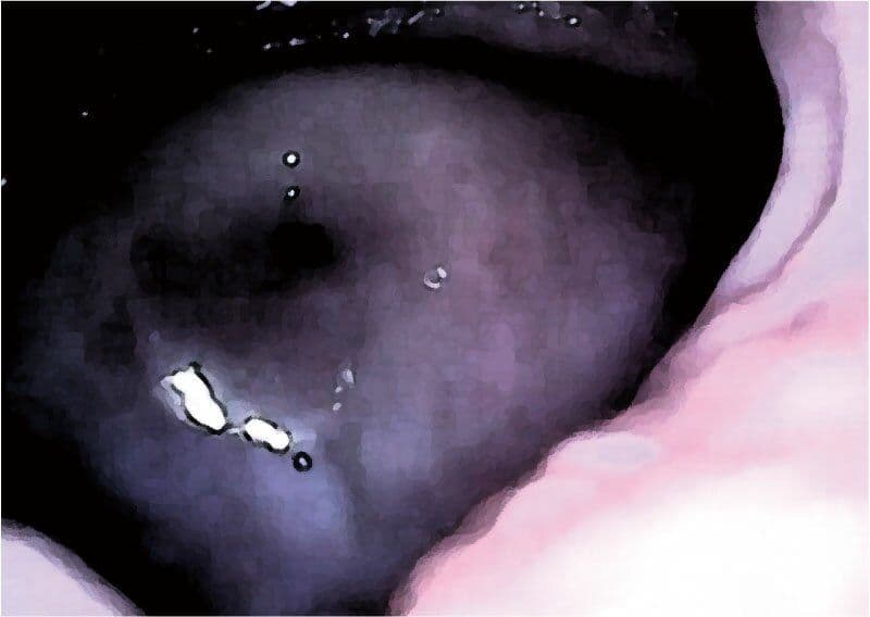 私の蟲姦遊び 第13話 妊娠中にヤスデ編 サンプル 4