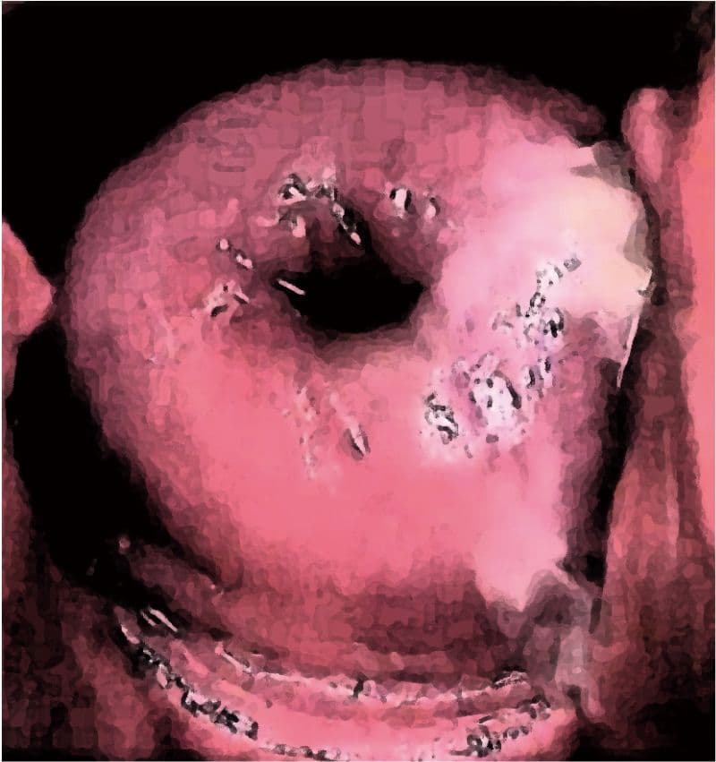 私の蟲姦遊び 第16 話 妊娠中にオオキベリアオゴミムシ編 サンプル 4