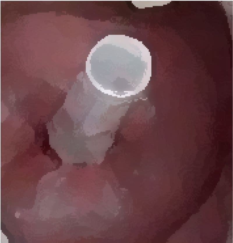 私の蟲姦遊び 第16 話 妊娠中にオオキベリアオゴミムシ編 サンプル 6