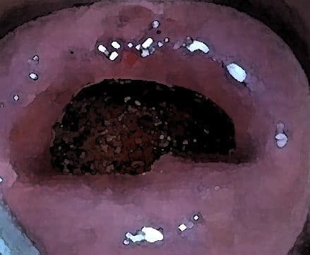 私の蟲姦遊び 17 話 妊娠中にスズメガのサナギ編 サンプル 4