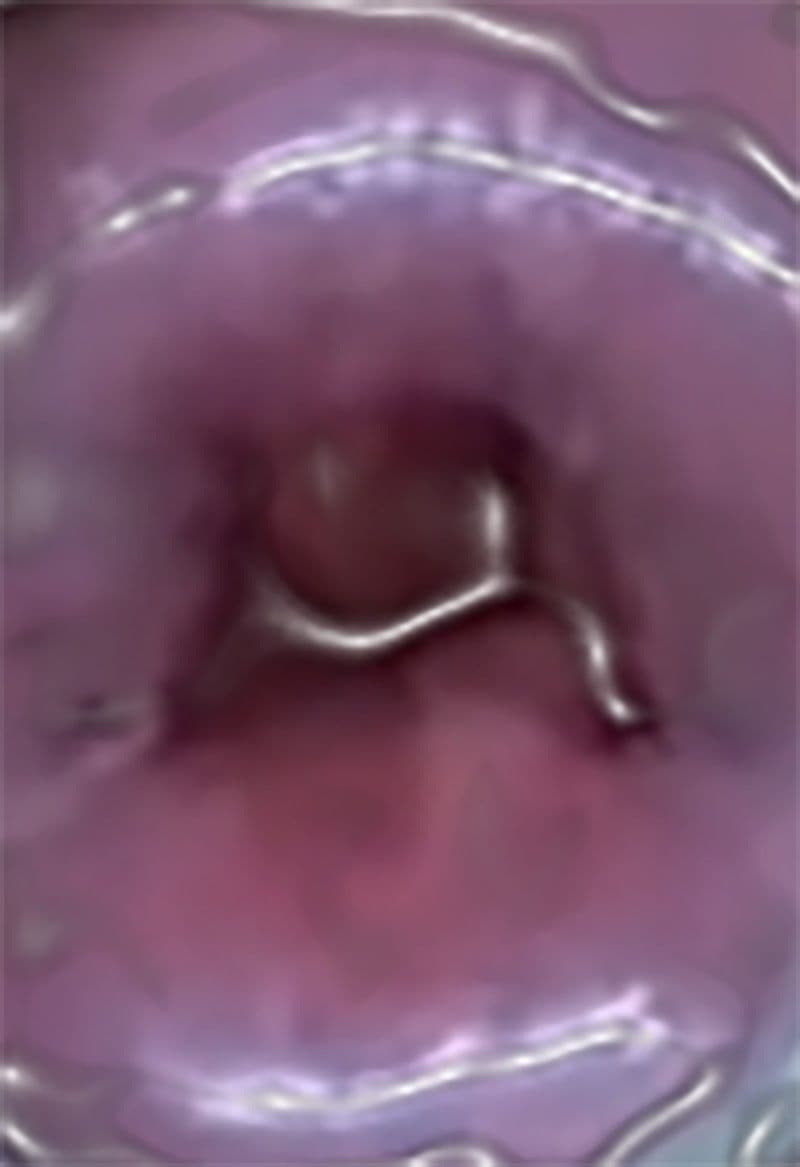 私の蟲姦遊び 17 話 妊娠中にスズメガのサナギ編 サンプル 5