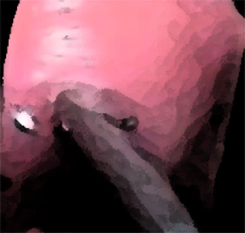 私の蟲姦遊び 18話 妊娠中に5 匹のミズアブの幼虫編 サンプル 3