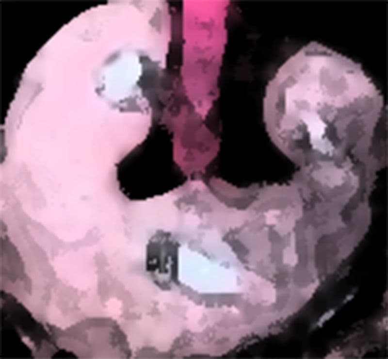 私の蟲姦遊び 18話 妊娠中に5 匹のミズアブの幼虫編 サンプル 5