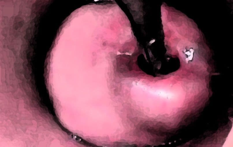 私の蟲姦遊び 19話 妊娠中に2匹のゴキブリの幼虫編 サンプル 3