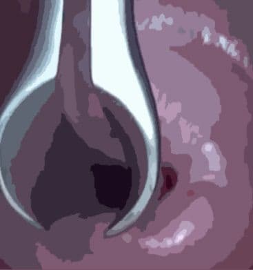 私の蟲姦遊び 21 話 妊娠中に3匹のユムシ編 全編 サンプル 5