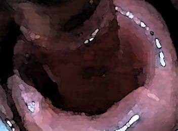 私の蟲姦遊び 22話 妊娠中にハサミムシ編 全編 サンプル 4