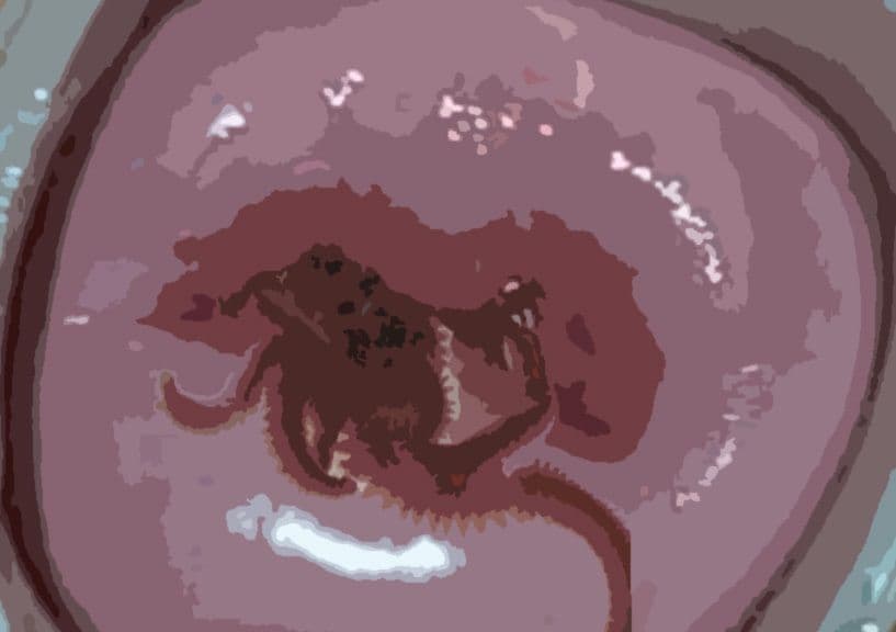 私の蟲姦遊び 24話 妊娠中に釣り餌のアオイソメ編 サンプル 4