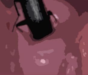 私の蟲姦遊び 25話 妊娠中にベランダにいたゴミムシ編 サンプル 4