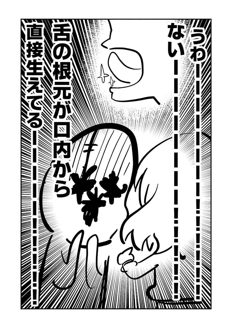 ベロをレーザーで焼いた話1 サンプル 7