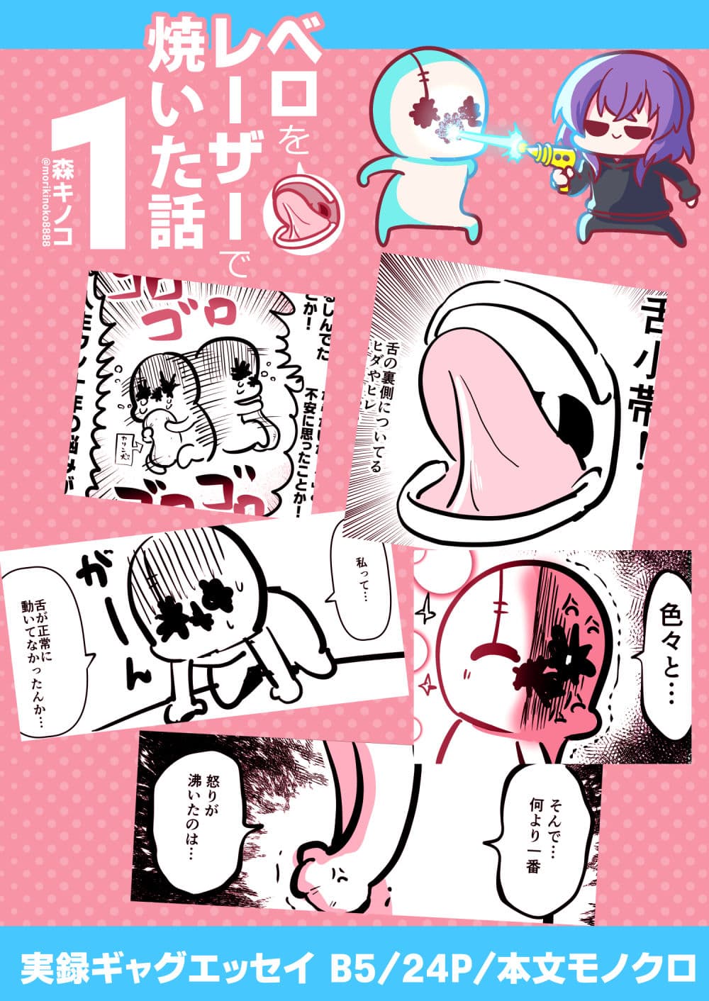 ベロをレーザーで焼いた話1 サンプル 8