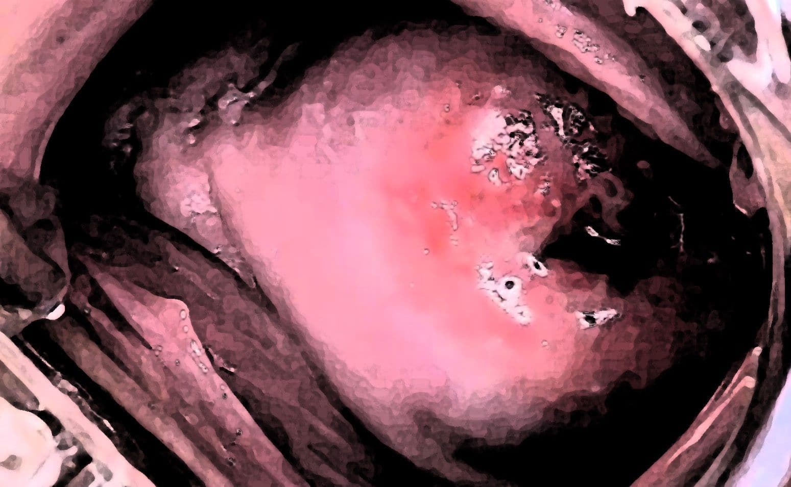 私の蟲姦遊び 27話 妊娠中にジャンボタニシの卵編 サンプル 6