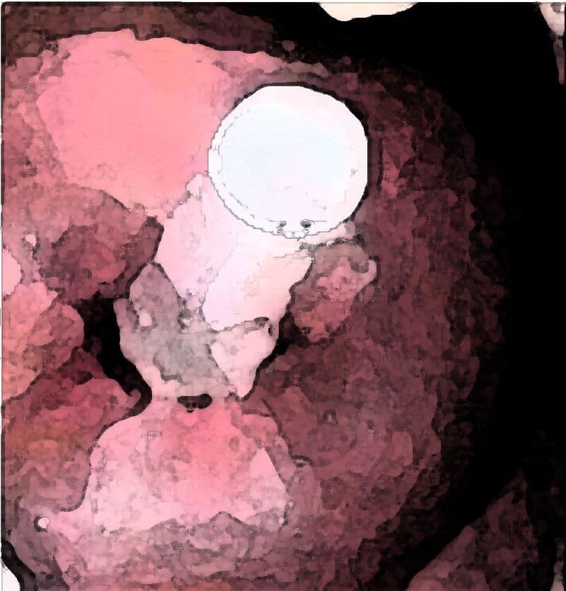 私の蟲姦遊び 27話 妊娠中にジャンボタニシの卵編 サンプル 7