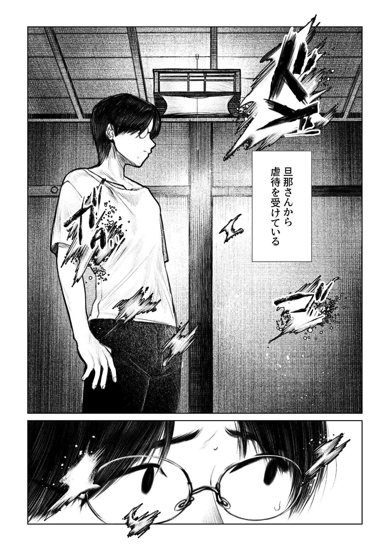 痣と痕 サンプル 2