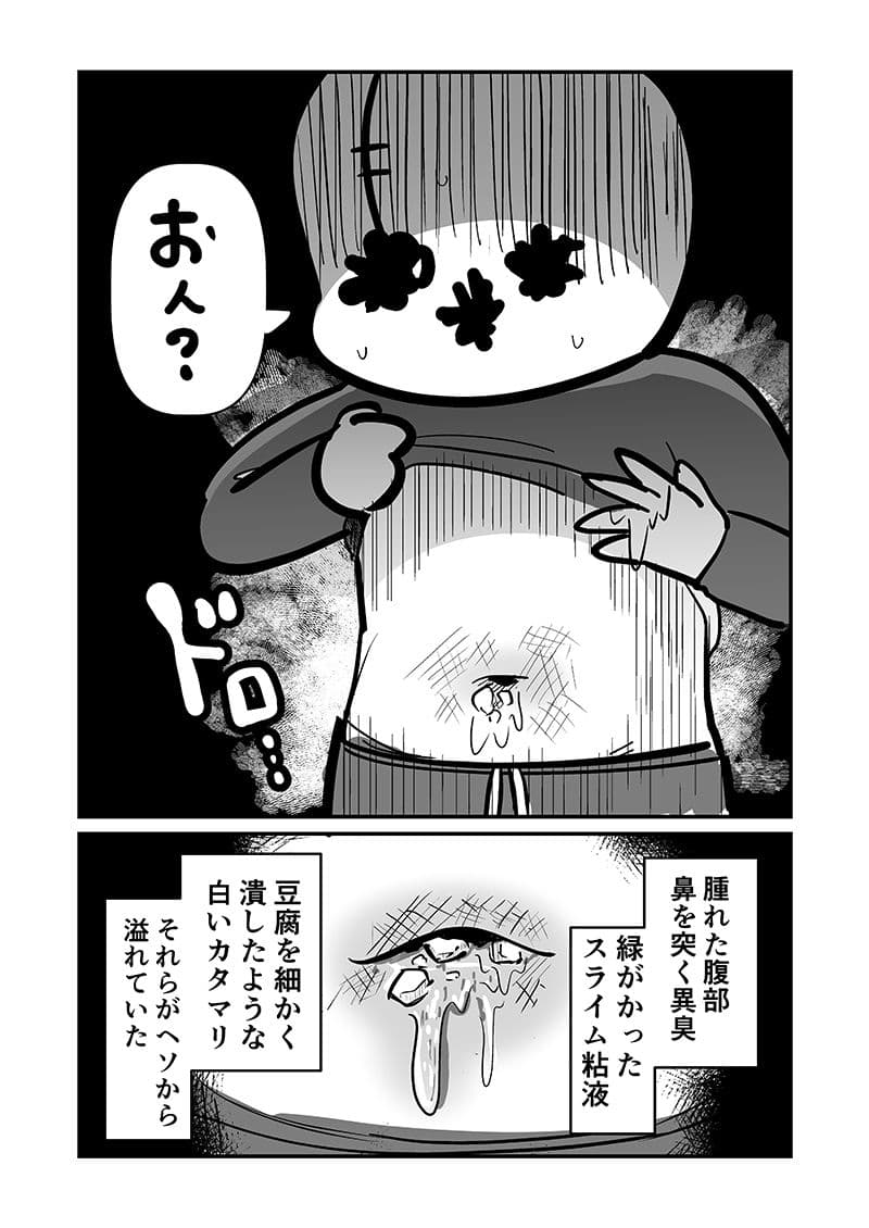 〆切に追われて栄養剤＋仮眠を繰り返していたらおヘソから膿が出て入院した話2 サンプル 4